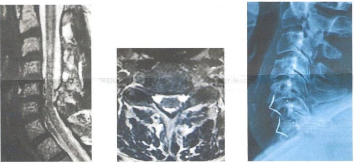 Radiologische Aufnahmen meiner HWS